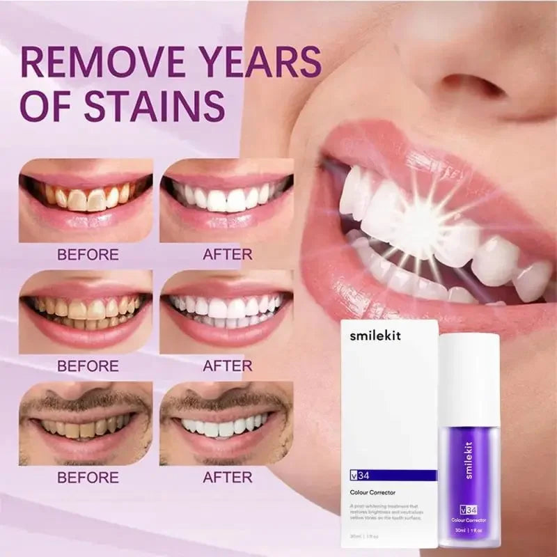 30ml SmileKit Purple Toothpaste l CLEARANCE SALE